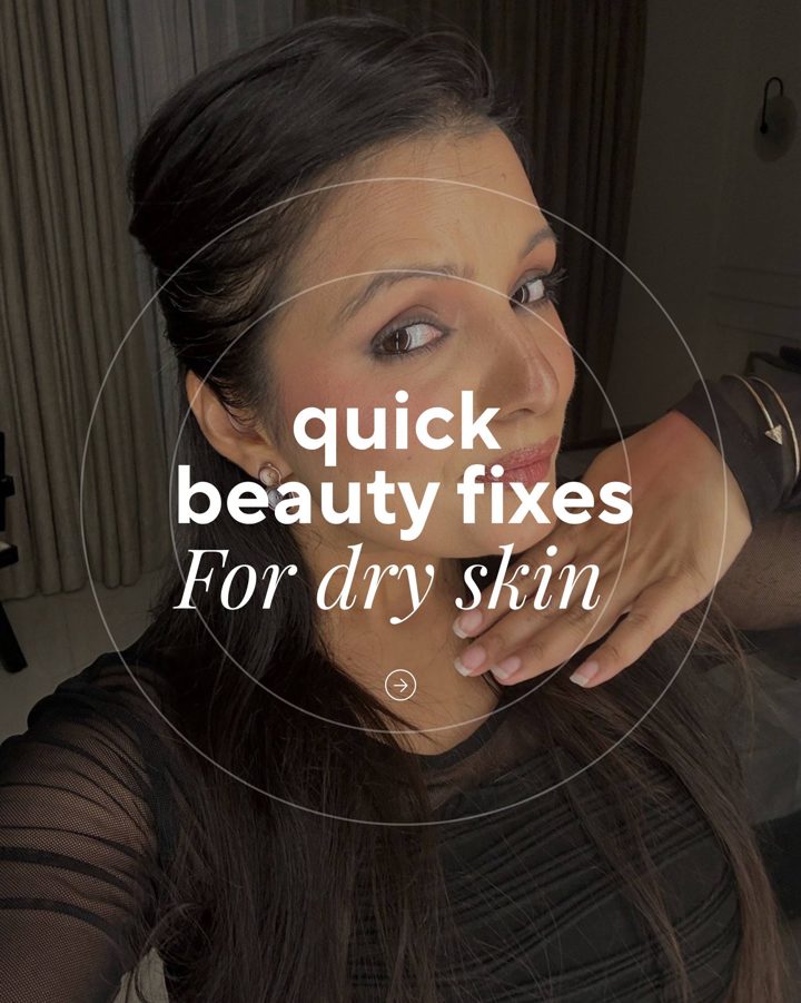 Contour Kahani: Quick beauty fixes for dry skin, slide 1
