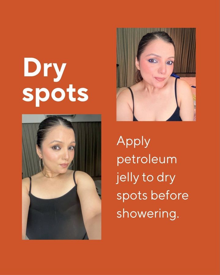 Contour Kahani: Quick beauty fixes for dry skin, slide 3
